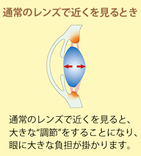 通常のレンズで近くを見るとき