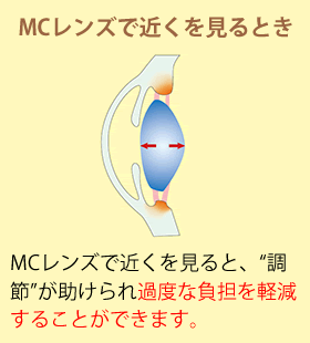 MCレンズで近くを見るとき